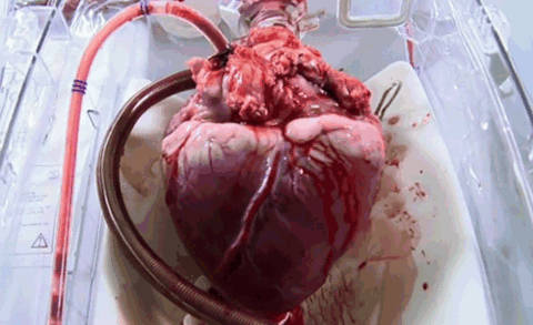 Serce to mięsień o wielkości zaciśniętej pięści – Ale potrafi zdziałać o wiele więcej niż zaciśnięta pieść 