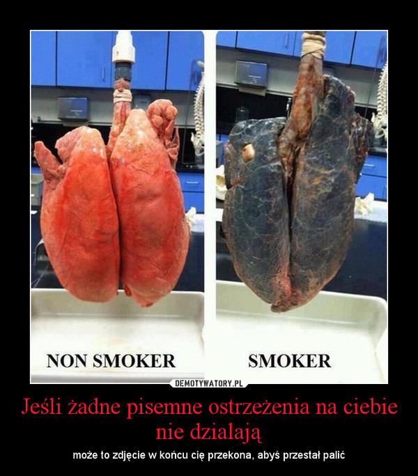 Jeśli żadne pisemne ostrzeżenia na ciebie nie dzialają – może to zdjęcie w końcu cię przekona, abyś przestał palić 