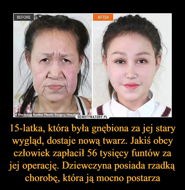 15-latka, która była gnębiona za jej stary wygląd, dostaje nową twarz. Jakiś obcy człowiek zapłacił 56 tysięcy funtów za jej operację. Dziewczyna posiada rzadką chorobę, która ją mocno postarza –  