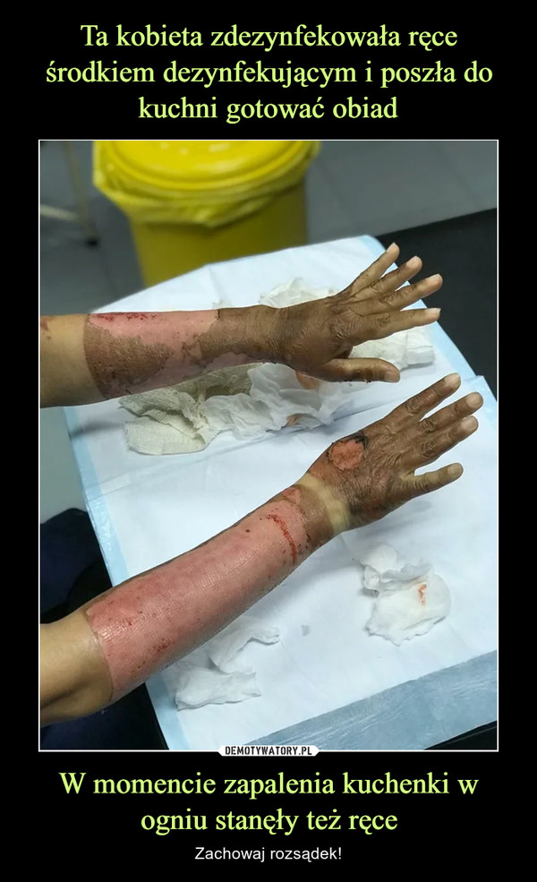 Ta kobieta zdezynfekowała ręce środkiem dezynfekującym i poszła do kuchni gotować obiad W momencie zapalenia kuchenki w ogniu stanęły też ręce