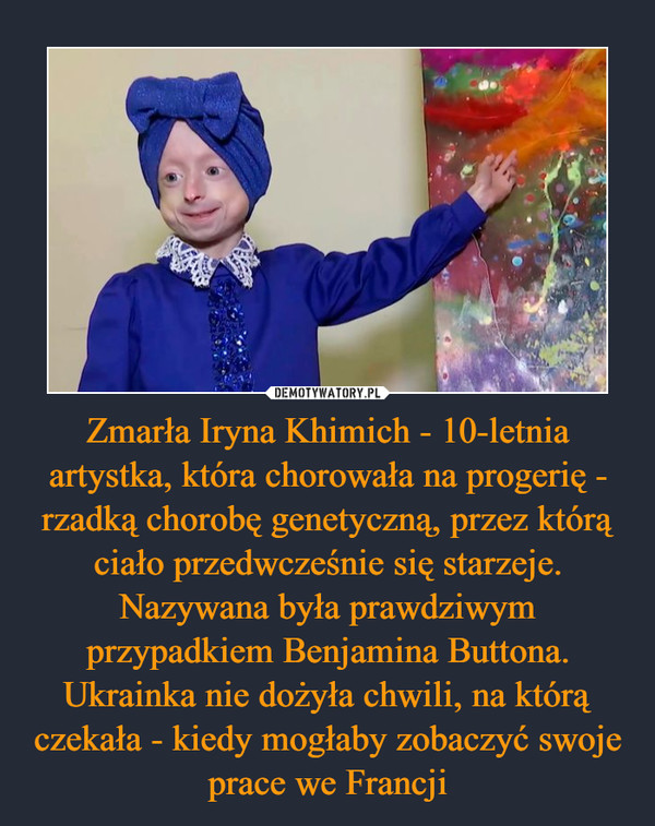 Zmarła Iryna Khimich - 10-letnia artystka, która chorowała na progerię - rzadką chorobę genetyczną, przez którą ciało przedwcześnie się starzeje. Nazywana była prawdziwym przypadkiem Benjamina Buttona. Ukrainka nie dożyła chwili, na którą czekała - kiedy mogłaby zobaczyć swoje prace we Francji