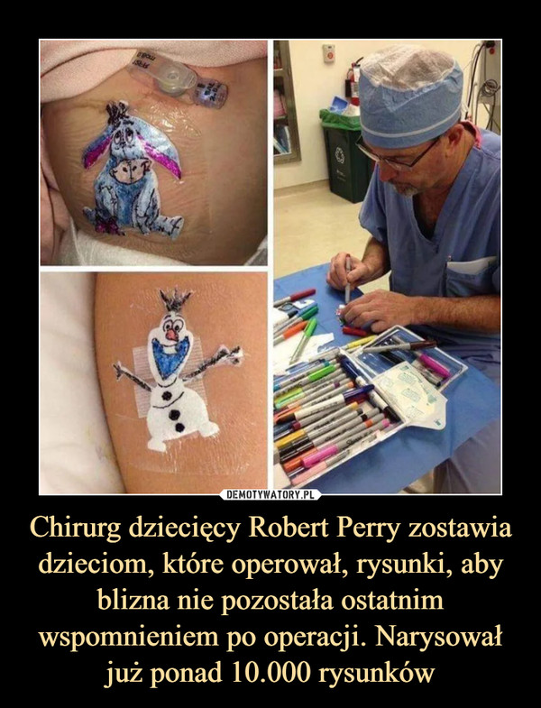 Chirurg dziecięcy Robert Perry zostawia dzieciom, które operował, rysunki, aby blizna nie pozostała ostatnim wspomnieniem po operacji. Narysował już ponad 10.000 rysunków –  